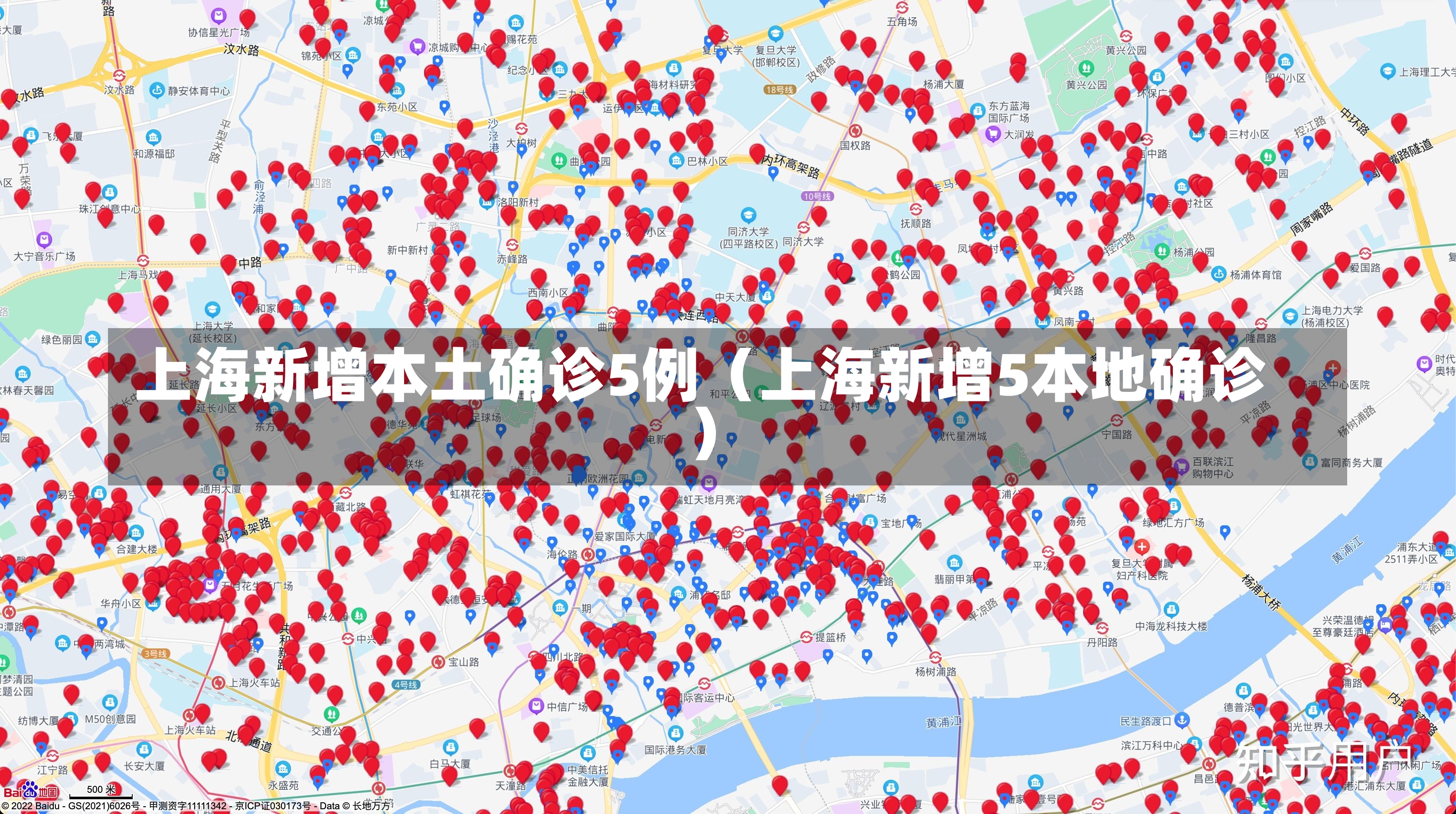 上海新增本土确诊5例（上海新增5本地确诊）